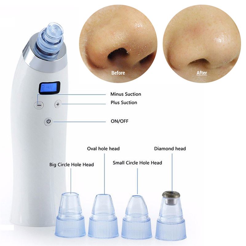 UNIQ Blackhead Suction Pro - Effective Rechargeable Blackhead Remover for pore cleansing - | Fashiongirl